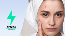 COMO TRATAR ACNES E ESPINHAS NO ROSTO
