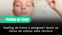 Peeling de Fenol é perigoso?